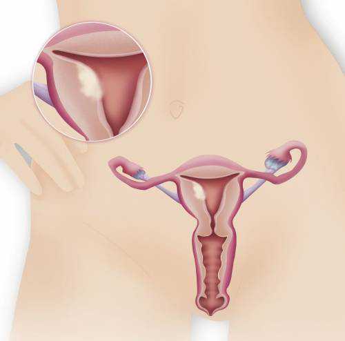 试管代孕包生男孩和龙凤胎的几率解析及卵巢早衰卵子少应对策略